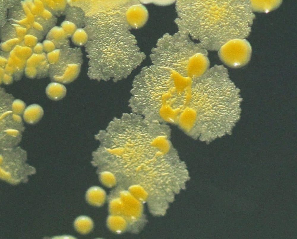 Mycobacterium Vaccae